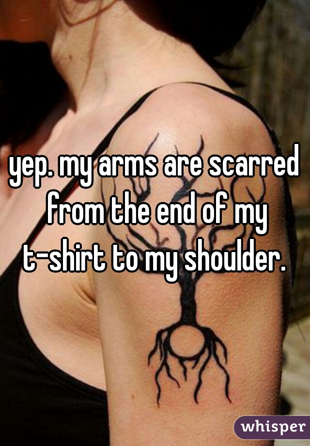 yep. my arms are scarred from the end of my t-shirt to my shoulder. 