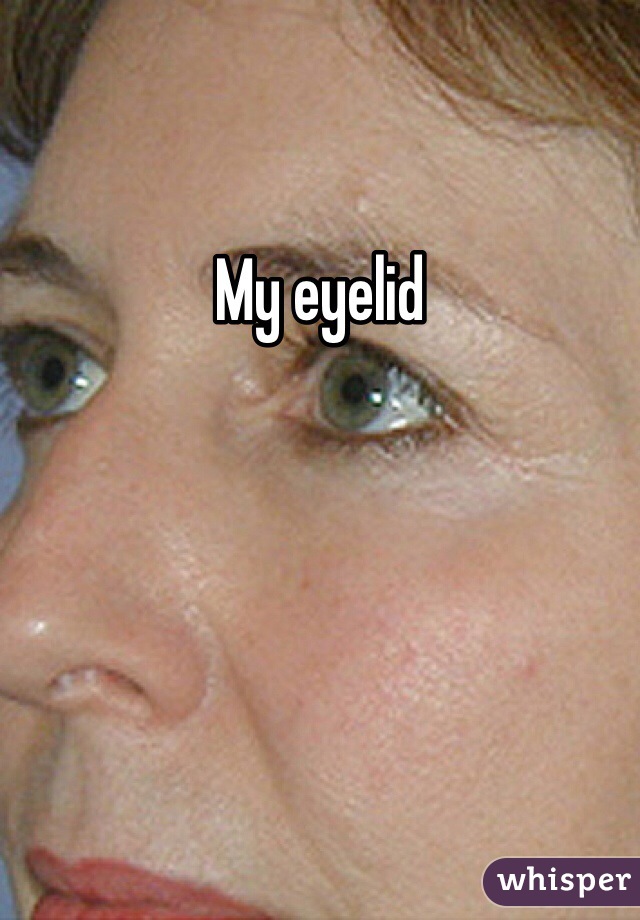 My eyelid 