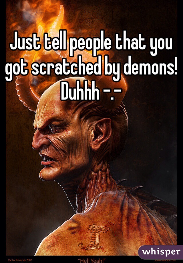 Just tell people that you got scratched by demons! Duhhh -.-
