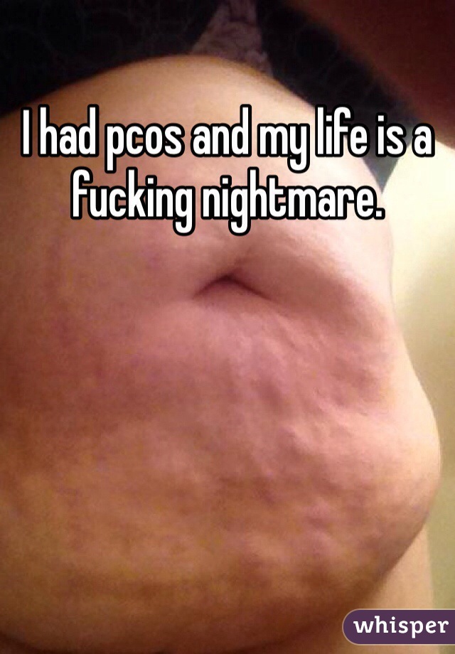 I had pcos and my life is a fucking nightmare.  