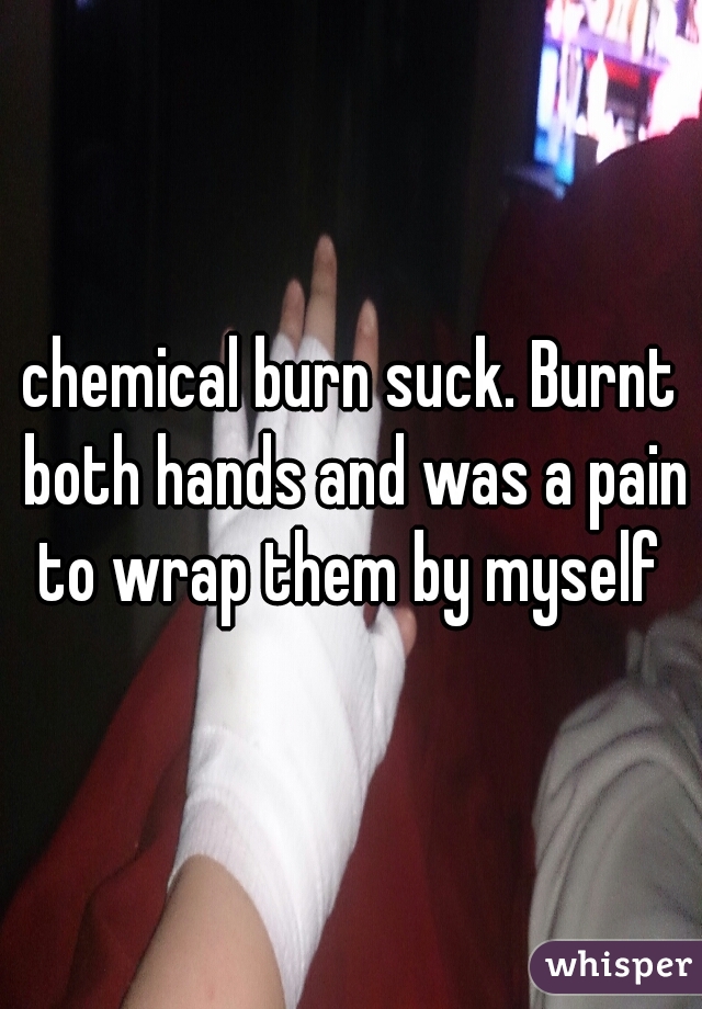chemical burn suck. Burnt both hands and was a pain to wrap them by myself 