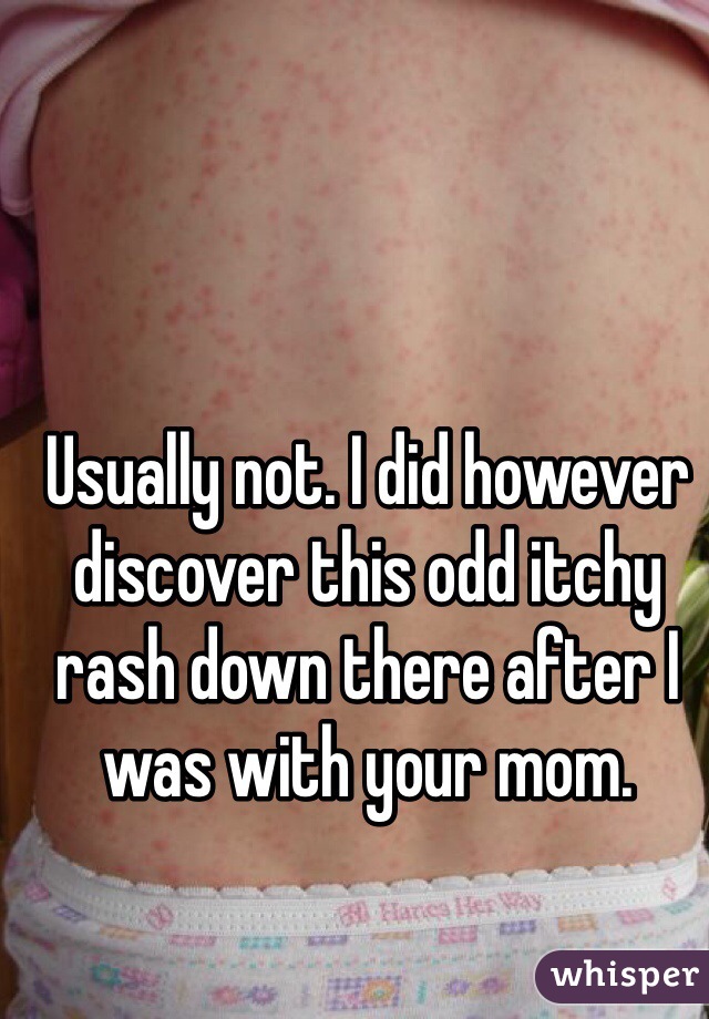 Usually not. I did however discover this odd itchy rash down there after I was with your mom. 