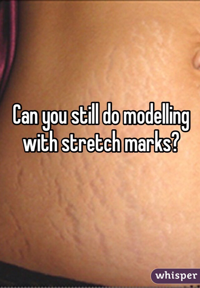 Can you still do modelling with stretch marks?