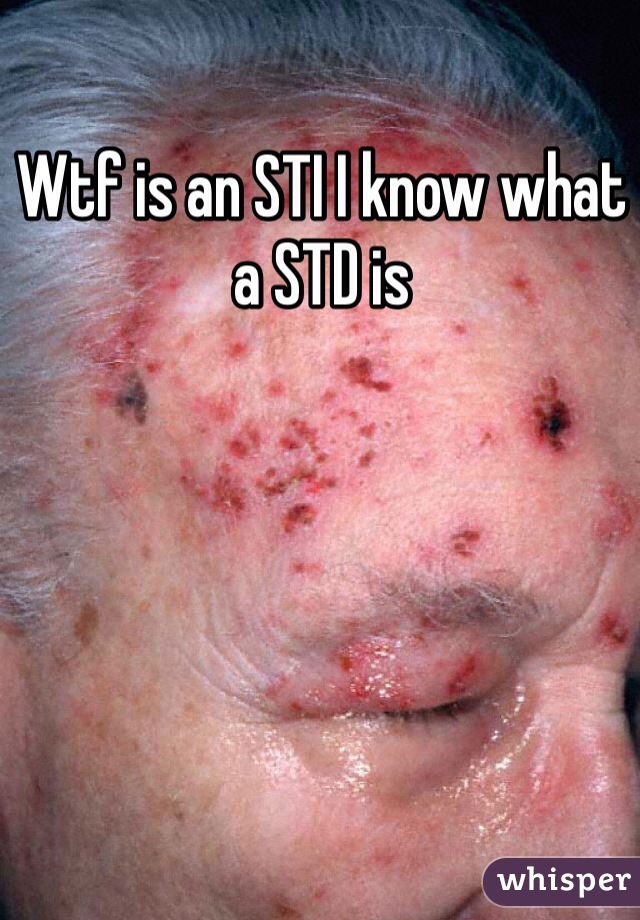 Wtf is an STI I know what a STD is 