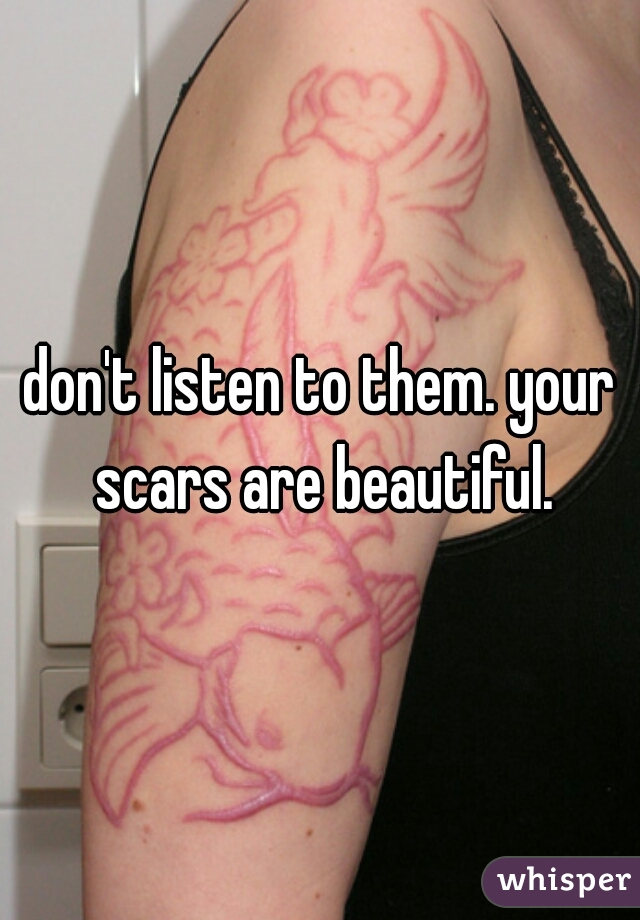 don't listen to them. your scars are beautiful.