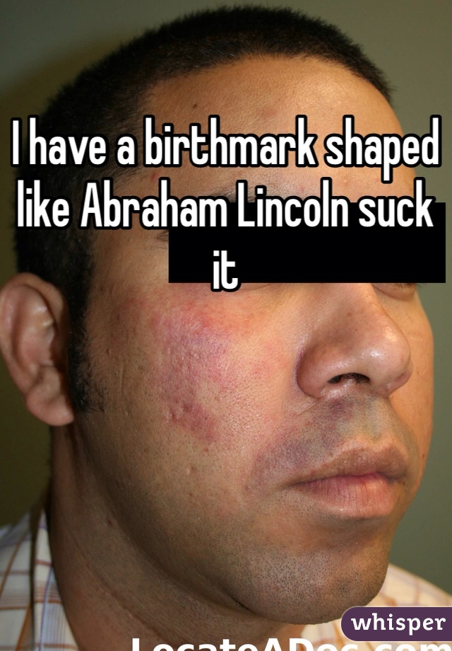 I have a birthmark shaped like Abraham Lincoln suck it