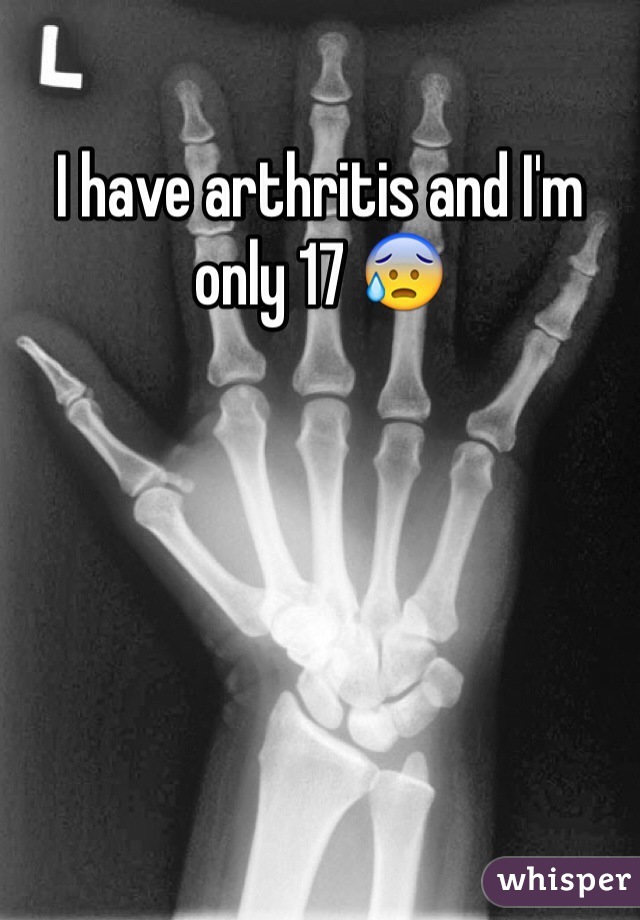 I have arthritis and I'm only 17 😰