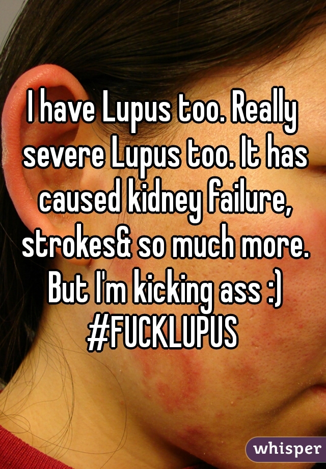 I have Lupus too. Really severe Lupus too. It has caused kidney failure, strokes& so much more. But I'm kicking ass :) #FUCKLUPUS 