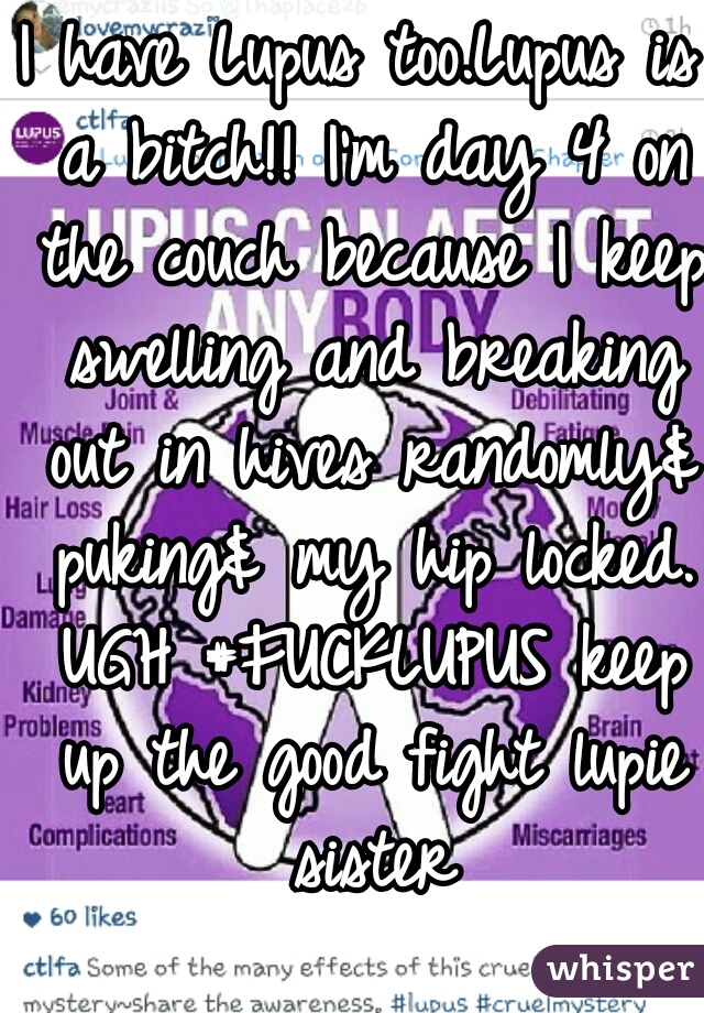 I have Lupus too.Lupus is a bitch!! I'm day 4 on the couch because I keep swelling and breaking out in hives randomly& puking& my hip locked. UGH #FUCKLUPUS keep up the good fight lupie sister