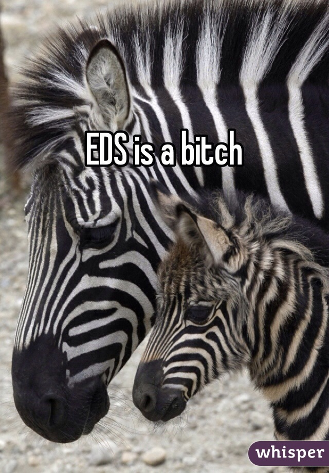 EDS is a bitch