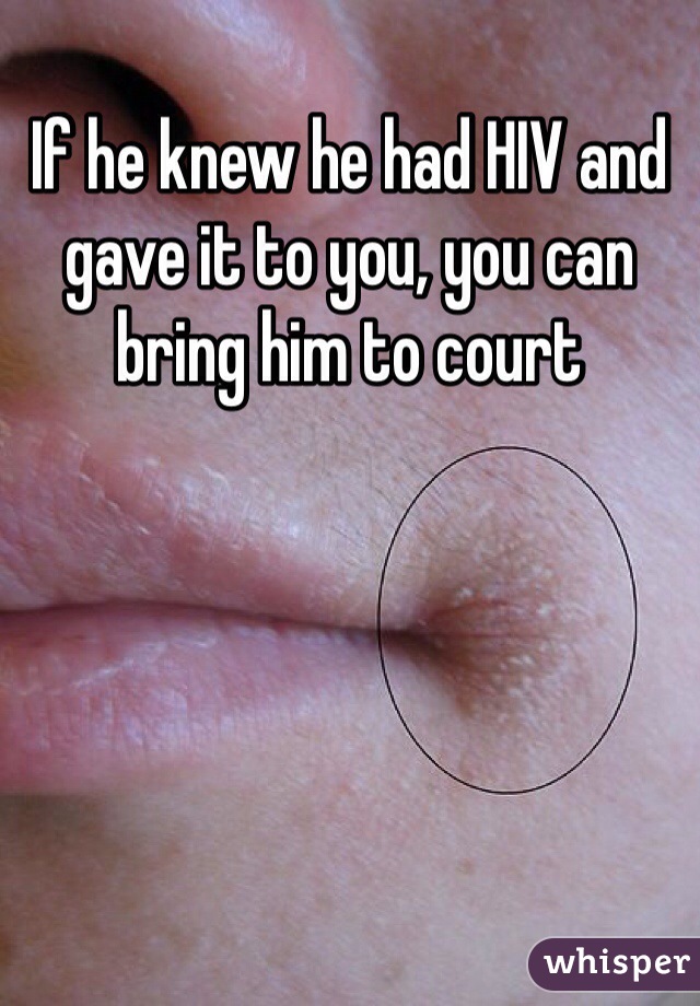 If he knew he had HIV and gave it to you, you can bring him to court