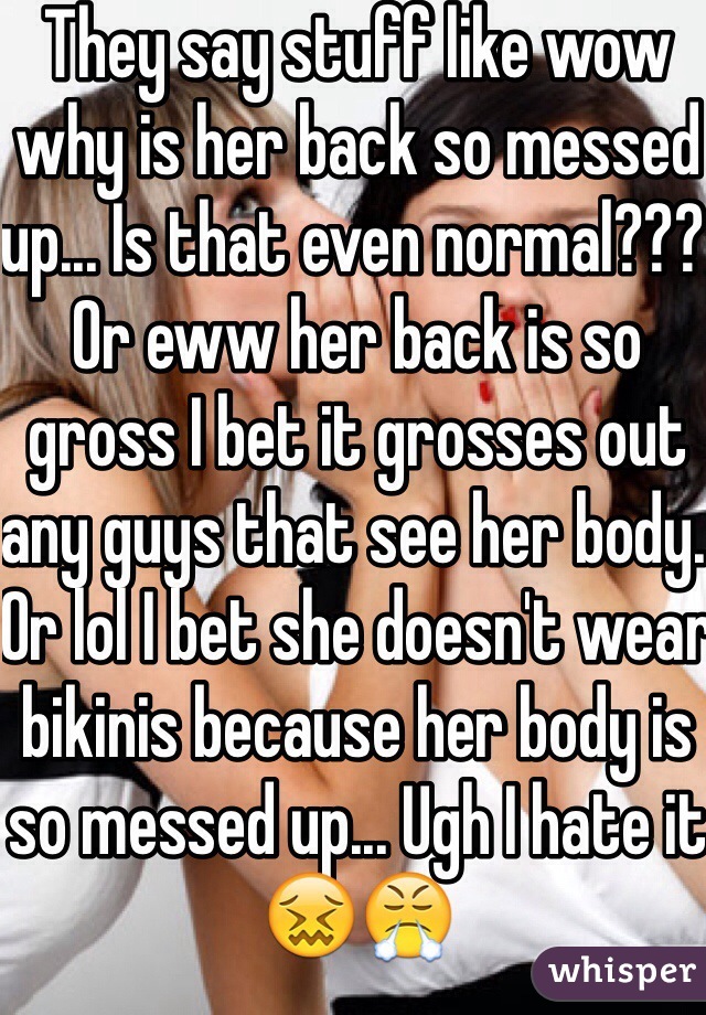 They say stuff like wow why is her back so messed up... Is that even normal??? Or eww her back is so gross I bet it grosses out any guys that see her body. Or lol I bet she doesn't wear bikinis because her body is so messed up... Ugh I hate it 😖😤