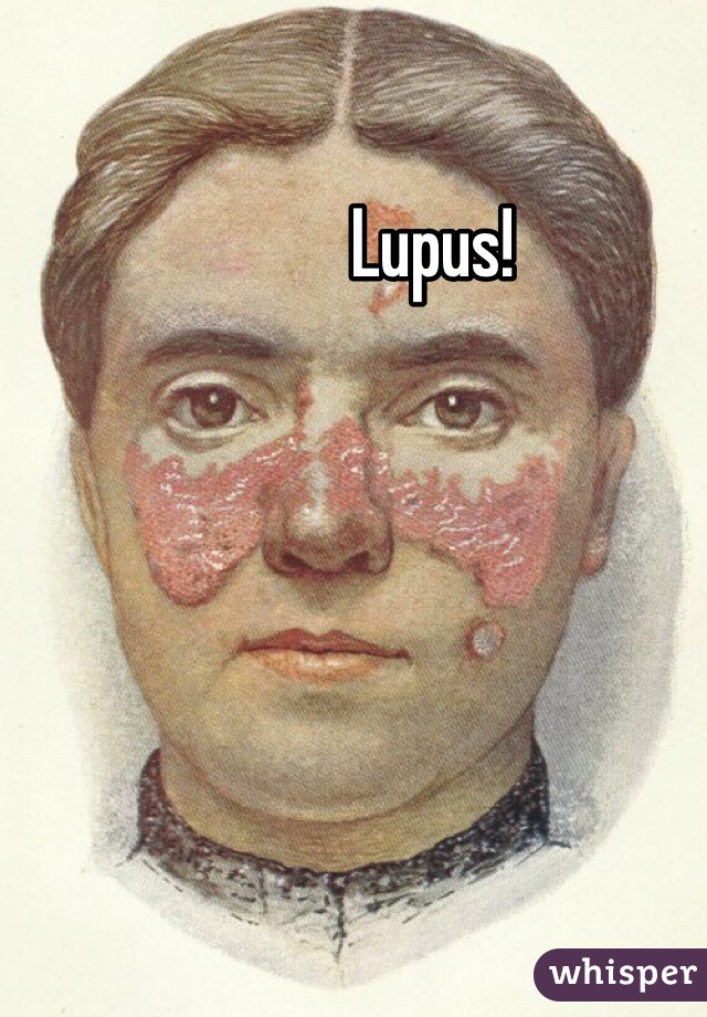 Lupus!