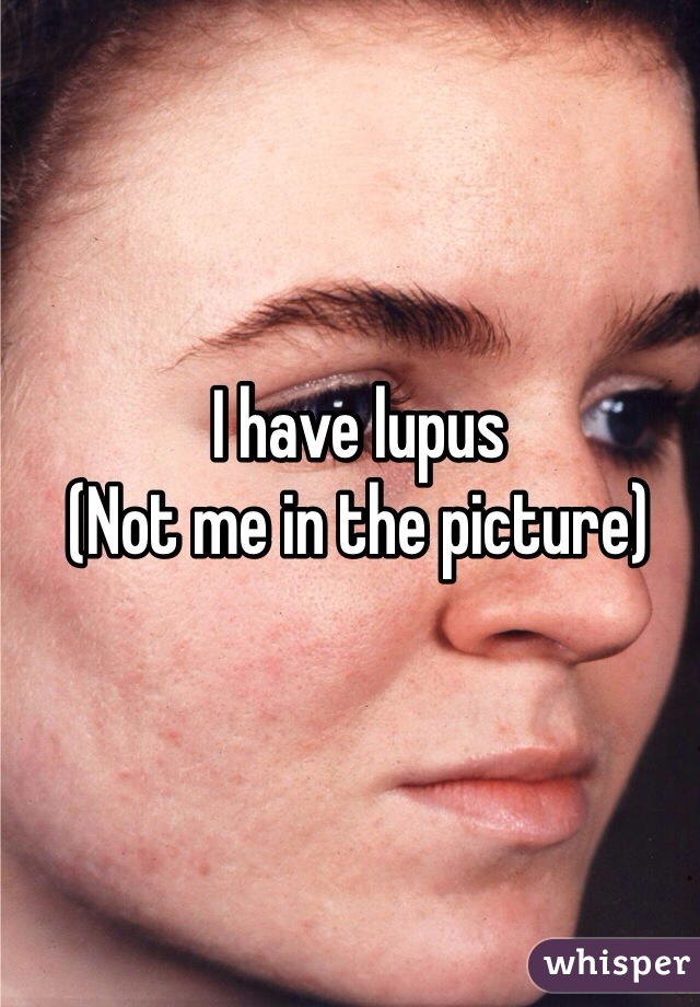 I have lupus
(Not me in the picture)