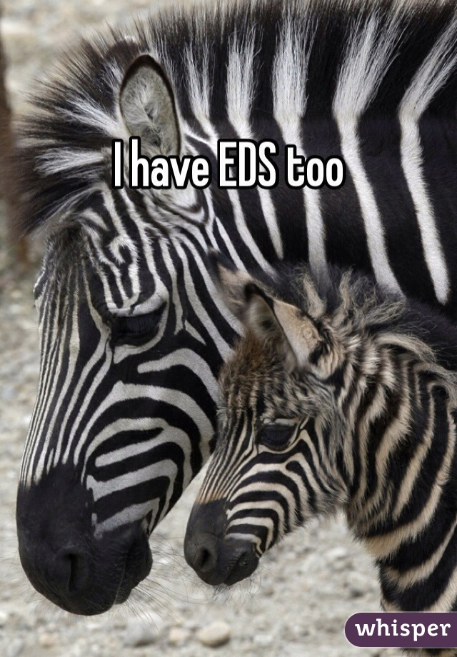 I have EDS too