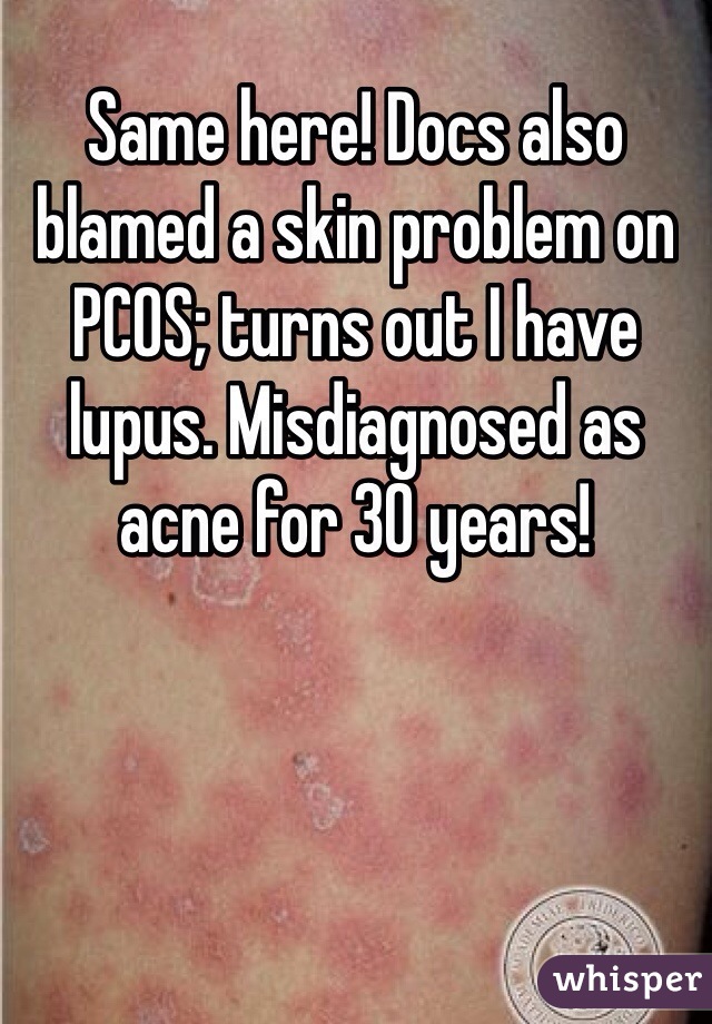 Same here! Docs also blamed a skin problem on PCOS; turns out I have lupus. Misdiagnosed as acne for 30 years!