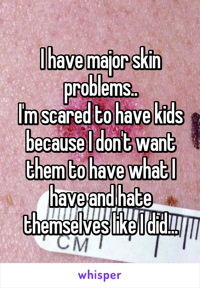 I have major skin problems..
I'm scared to have kids because I don't want them to have what I have and hate themselves like I did...
