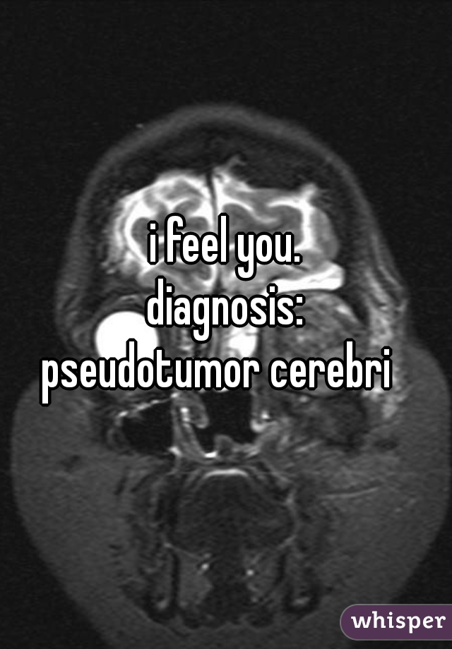 i feel you.

diagnosis:
pseudotumor cerebri  