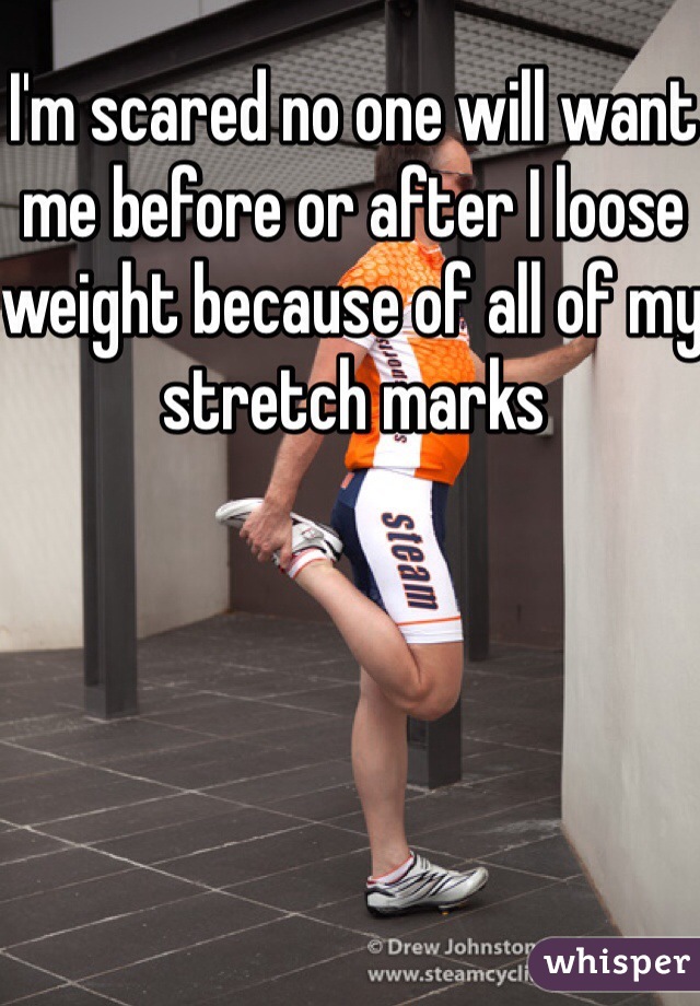 I'm scared no one will want me before or after I loose weight because of all of my stretch marks 