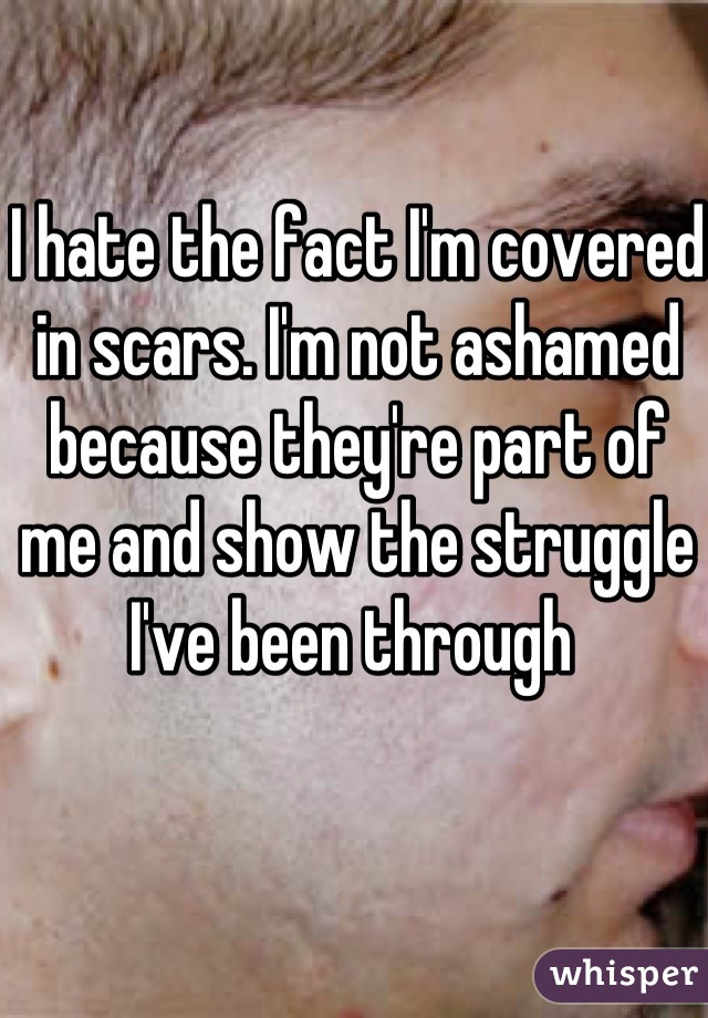 I hate the fact I'm covered in scars. I'm not ashamed because they're part of me and show the struggle I've been through 