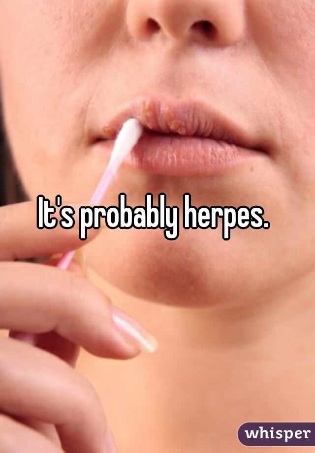 It's probably herpes. 