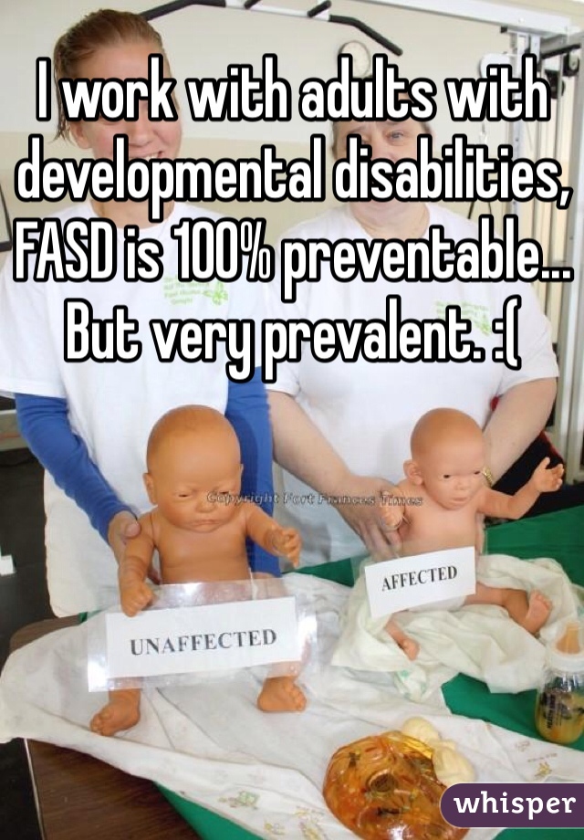 I work with adults with developmental disabilities, FASD is 100% preventable... But very prevalent. :( 