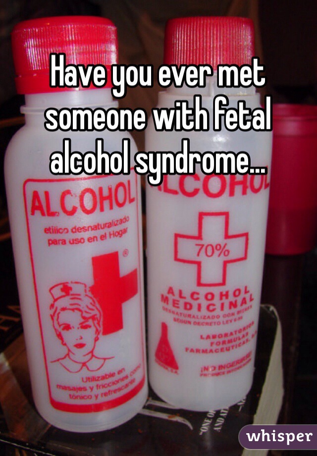 Have you ever met someone with fetal alcohol syndrome...