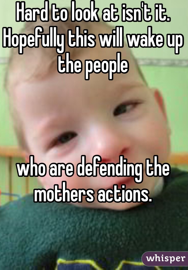 Hard to look at isn't it. Hopefully this will wake up the people 



who are defending the mothers actions. 