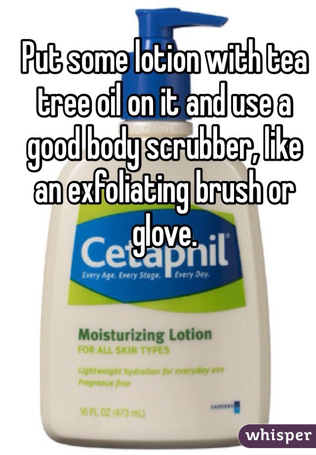 Put some lotion with tea tree oil on it and use a good body scrubber, like an exfoliating brush or glove.