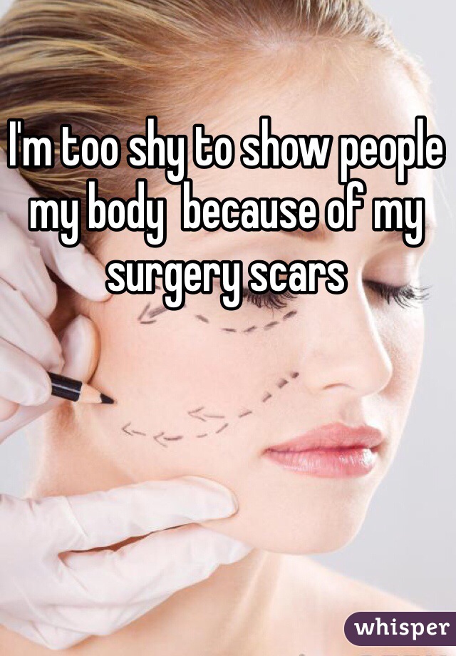 I'm too shy to show people my body  because of my surgery scars 