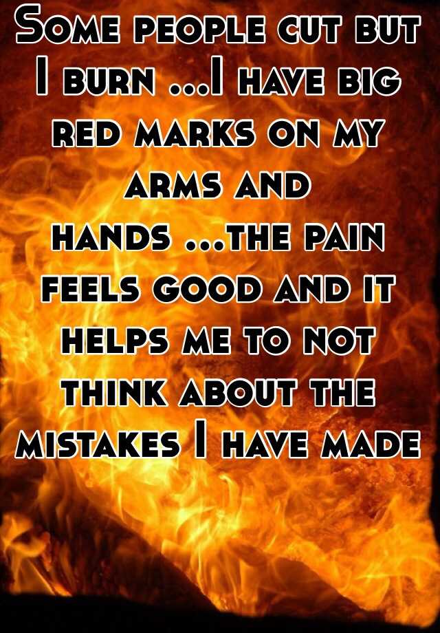 some-people-cut-but-i-burn-i-have-big-red-marks-on-my-arms-and-hands