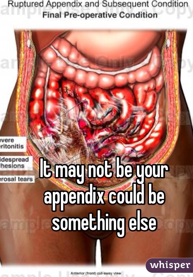 It may not be your appendix could be something else