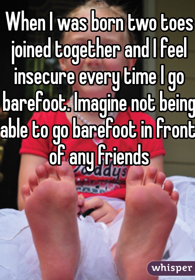 When I was born two toes joined together and I feel insecure every time I go barefoot. Imagine not being able to go barefoot in front of any friends