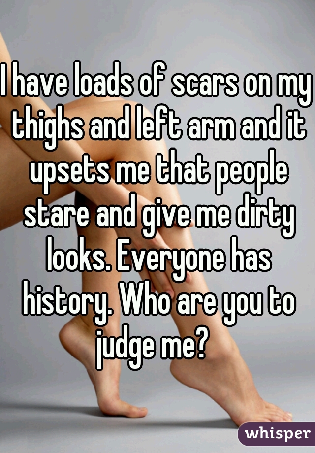 I have loads of scars on my thighs and left arm and it upsets me that people stare and give me dirty looks. Everyone has history. Who are you to judge me?  