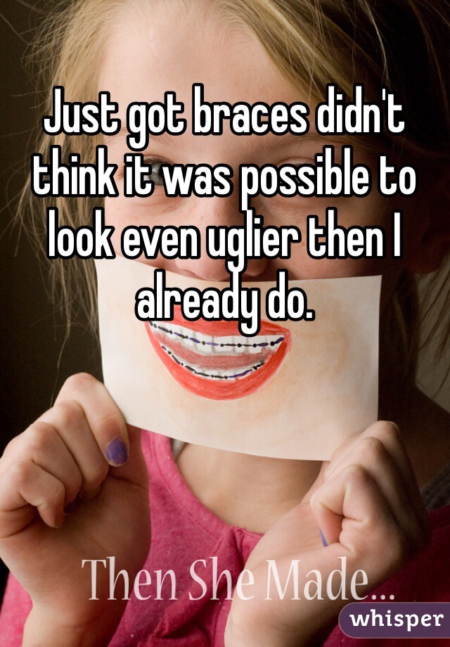 Just got braces didn't think it was possible to look even uglier then I already do.