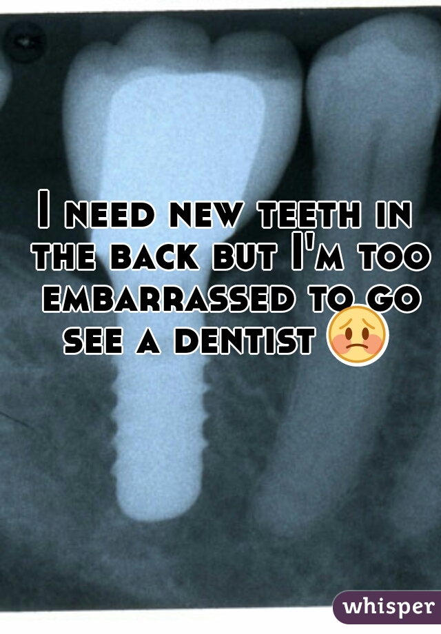 I need new teeth in the back but I'm too embarrassed to go see a dentist 😳  