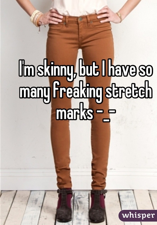 I'm skinny, but I have so many freaking stretch marks -_-