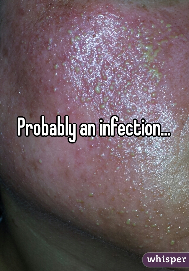 Probably an infection...