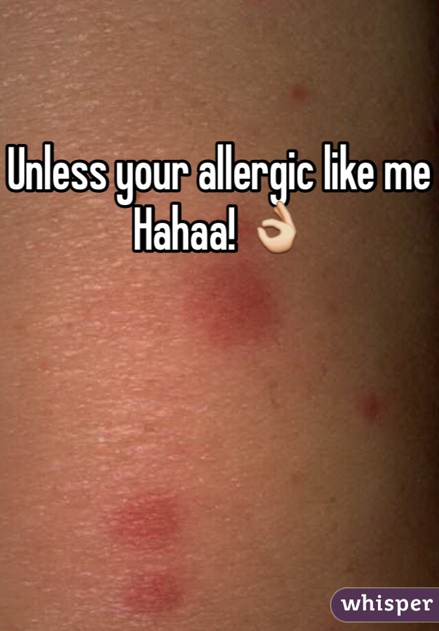 Unless your allergic like me
Hahaa! 👌