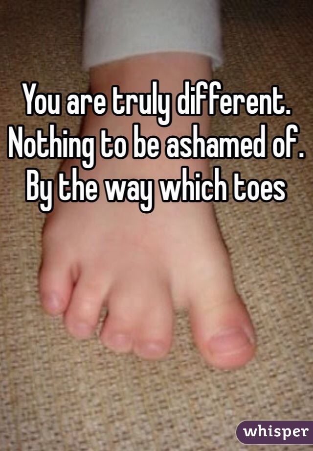 You are truly different. Nothing to be ashamed of. By the way which toes