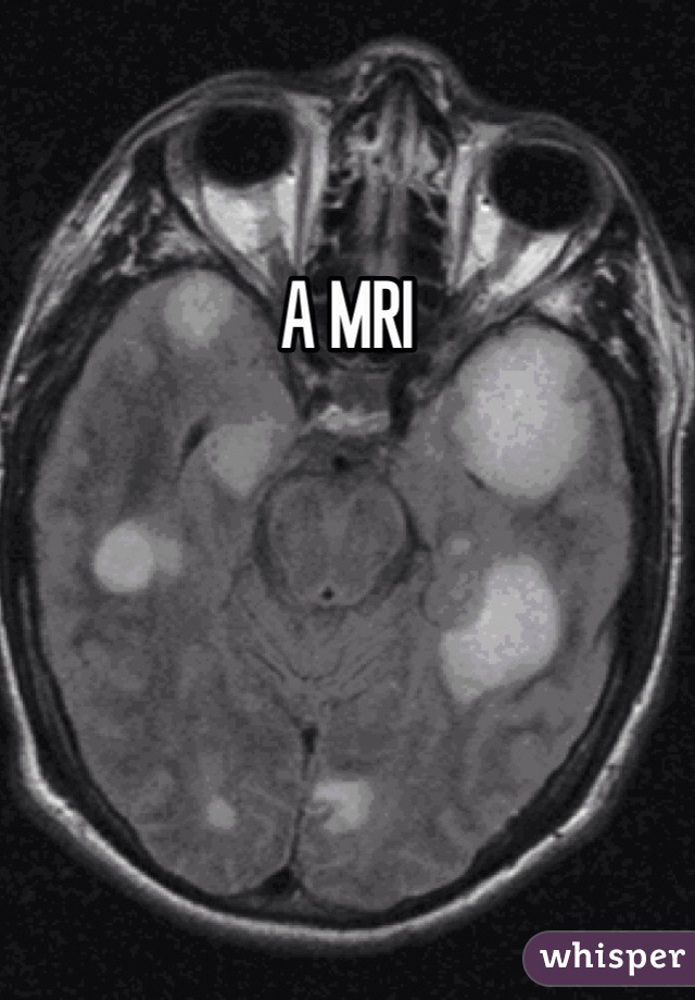 A MRI 