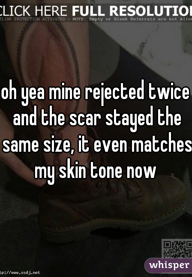 oh yea mine rejected twice and the scar stayed the same size, it even matches my skin tone now 