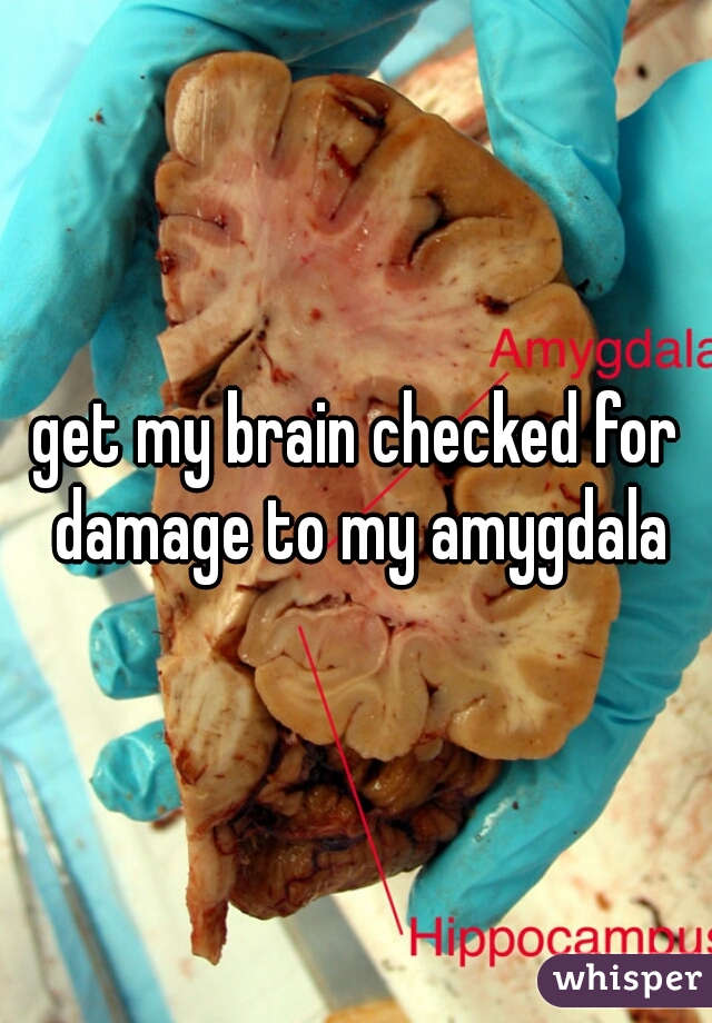 get my brain checked for damage to my amygdala