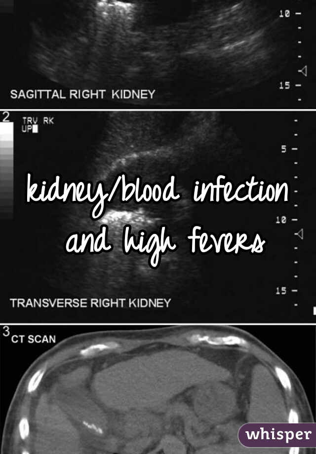 kidney/blood infection and high fevers