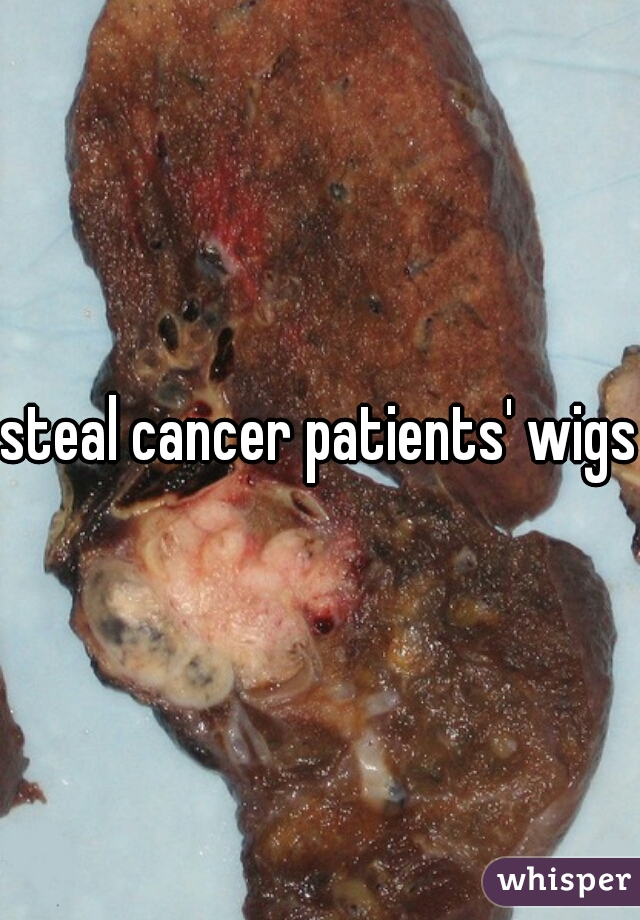 steal cancer patients' wigs.
