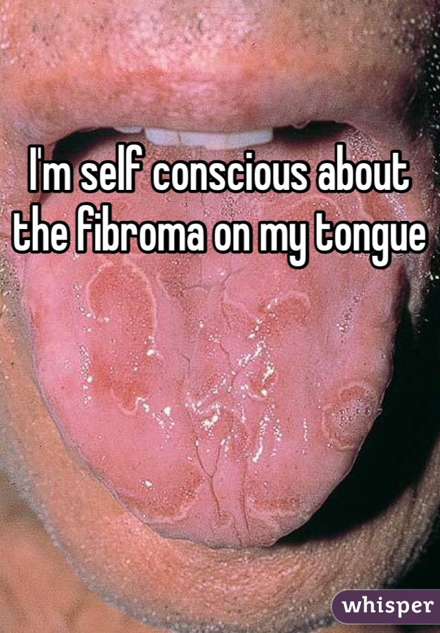 I'm self conscious about the fibroma on my tongue 