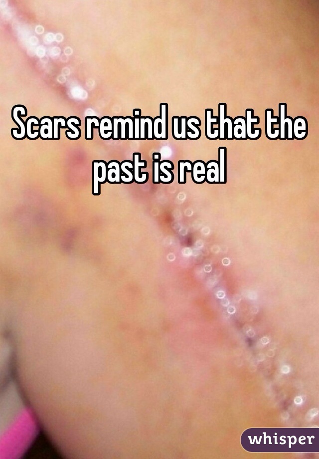 Scars remind us that the past is real