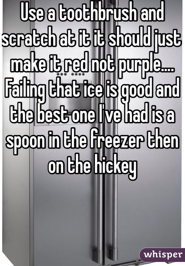 Use a toothbrush and scratch at it it should just make it red not purple.... Failing that ice is good and the best one I've had is a spoon in the freezer then on the hickey