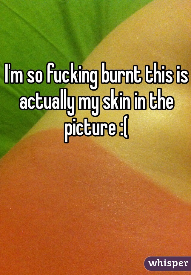 I'm so fucking burnt this is actually my skin in the picture :(