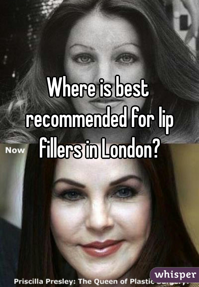 Where is best recommended for lip fillers in London?